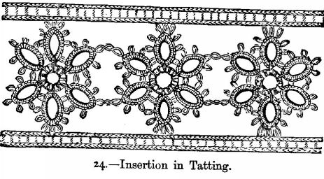 Insertion in Tatting.