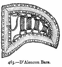 D'Alençon Bars.