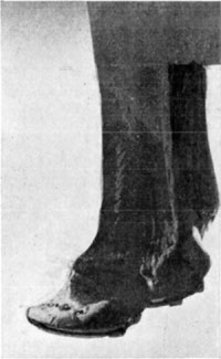 Fig. 33—The hoof in chronic laminitis. Note the concavity. This animal was serviceable for any work that could be performed at a walk.