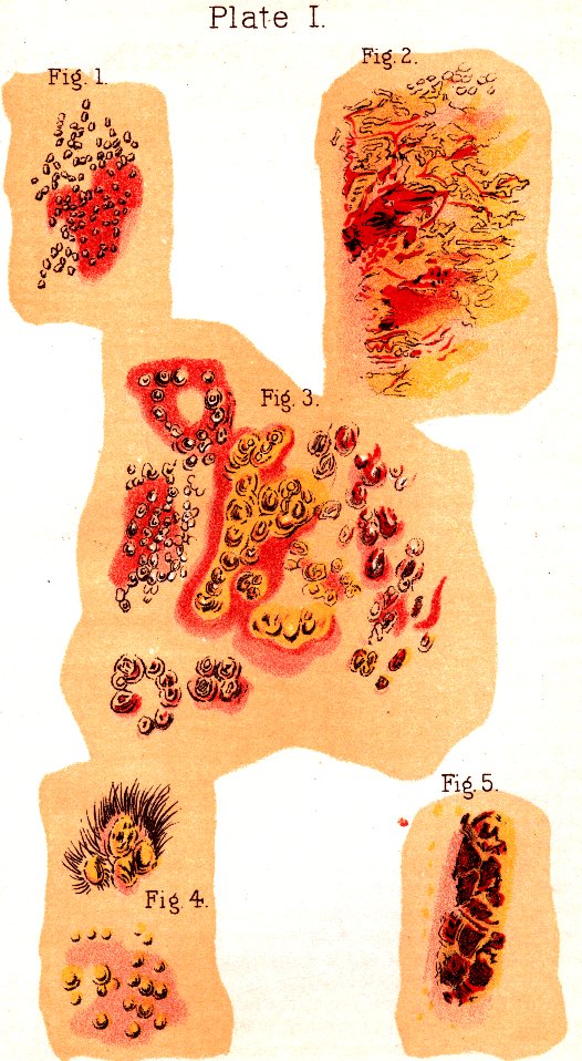 Illustration: Plate I. Fig. 1. Fig. 2. Fig. 3. Fig. 4. Fig. 5.