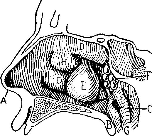 Illustration: Fig. 13. NASAL POLYPI.