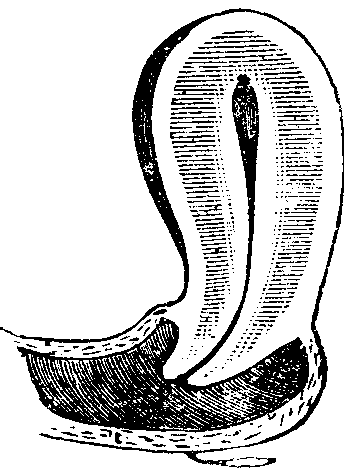 Illustration: Fig. 9. Conoid Neck.