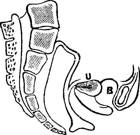 Illustration: Fig. 11. Version, u, Uterus, B, Bladder.