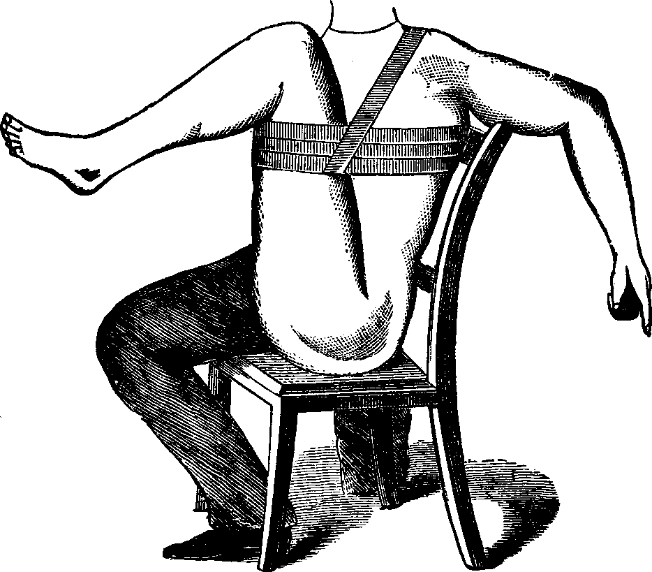 Illustration: Mode of employing flexion for the arrest of hemorrhage from a wound located between the thigh and knee.