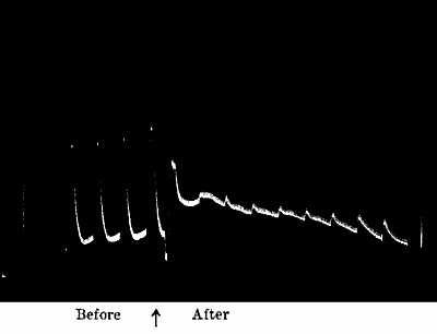 Fig. 49.—Nearly Complete Abolition of Response by Strong KOH