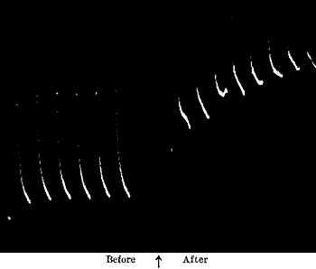 Fig. 91.—Depressing Effect of KBr (10 per Cent.) on the Response of Tin