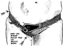 'How leg strap pulls pad on pelvic bone'