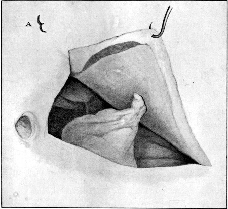 Fig. 25 (b).