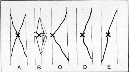 Fig. 50.