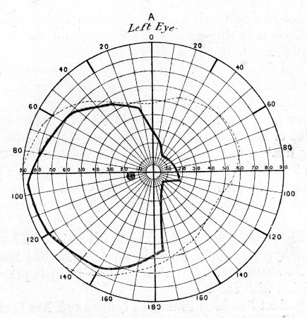 Fig. 74.