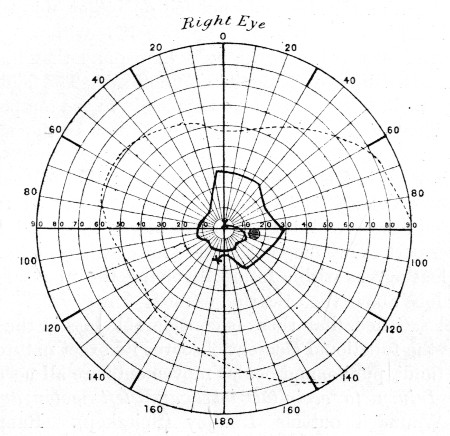 Fig. 75.