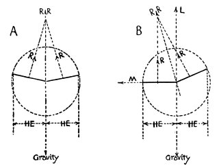     R, Direction of reaction of wing indicated.   R R, Resultant direction of reaction of both wings.     M, Horizontal (sideway) component of reaction.     L, Vertical component of reaction (lift).