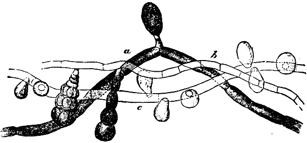 Fig. 2.—GROUP OF PYRENOMYCETES, A SPECIES OF FUNGI FREQUENT IN THE WATERS OF MINES.