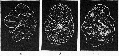 Fig. 146.—Types of colonies: a, Reticulate; b, gyrose; c, marmorated.