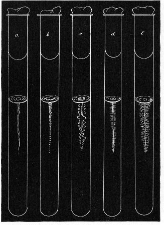 Fig. 150.—Stab cultivations—types of growth: a, Filiform; b, beaded; c, echinate; d, villous; e, arborescent.