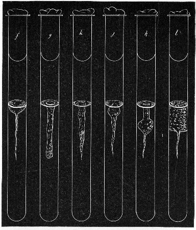 Fig. 151.—Stab cultivations—types of growth: f, Crateriform; g, saccate; h, infundibuliform; j, napiform; k, fusiform; l, stratiform.