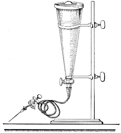 Fig. 173.—Conical separatory funnel, fitted for injection of fluid cultivations.