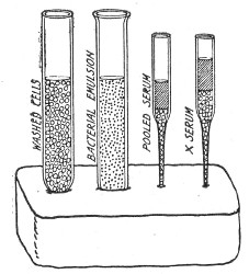 Fig. 194.—Plasticine block with materials arranged for opsonin estimations.