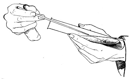 Fig. 68.—Holding tubes for removing bacterial growth, as seen from the front.