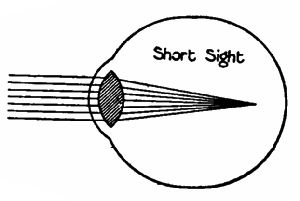 Fig. 117a.