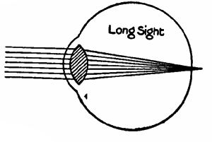 Fig. 118a.