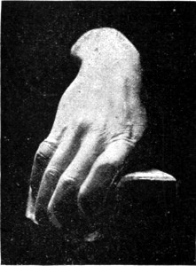 HENRY IRVING'S HAND.