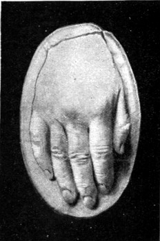 LISZT'S HAND.