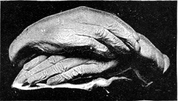 WILKIE COLLINS'S HANDS.