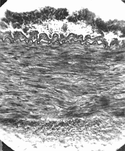 Fig. 1.—Cross section of a large artery showing the division into the three coats; intima, media, adventitia. The intima is a thin line composed of endothelial cells. The wavy elastic lamina is well seen. The thick middle coat is composed of muscle fibers and fibroelastic tissue. The loose tissue on the outer (lower portion of cut) side of the media is the adventitia. (Microphotograph, highly magnified.)