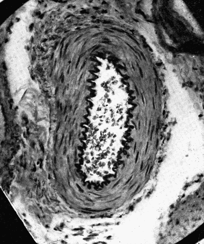 Fig. 10.—Cross-section of a small artery in the mesentery. Note that the vessel appears capable of being much widened. The internal elastic lamina is thrown into folds somewhat resembling the convolutions of the brain. Note also that the middle coat of the artery is composed almost entirely of muscle. The enormous number of such vessels in the mesentery and intestines explains the ability of the splanchnic area to accommodate the greater part of the blood in the body. Universal constriction of these vessels would naturally render the intestines anemic. The vasomotor control of these vessels plays an important rôle in the distribution of the blood. Small arteries in the skin and in other organs, possibly the brain, have a similar function. (Microphotograph, highly magnified".)