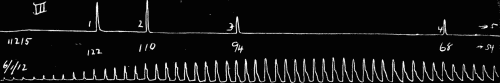 Fig. 31.—Fast drum. Sudden decrease in size of pulse wave at 4, marking the change from clear sharp tone to dull tone.