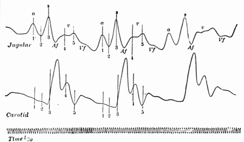 Fig. 36.—Simultaneous tracings of the jugular and carotid pulses showing normal waves in the venous pulse and relation to carotid pulse. (After Bachmann.)