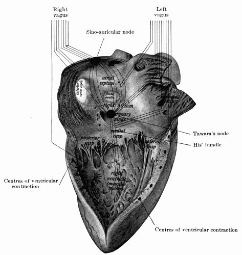 Fig. 38.—Right side of the heart showing diagrammatically the distribution of the two vagus nerves to different parts of the viscus....(Hare's Practice of Medicine.)