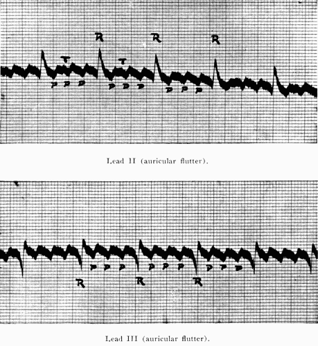 Fig. 40.—(After Hart.)