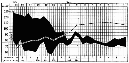 Fig. 43.—The shaded area represents the pulse deficit; the upper edge is the apex rate, the lower edge the radial rate. The broken line indicates the "average systolic blood pressure." (Compare these values with the figures at the bottom of the chart, which show the systolic blood pressure determined by the usual method.) (After Hart.)