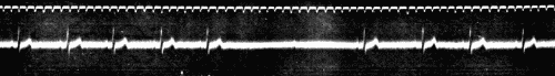 Fig. 52.—Influence of mechanical pressure on the right vagus nerve. (After Eyster and Evans.)