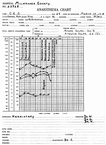 Fig. 54.—Blood pressure record from a normal reaction to ether. Note that the systolic and diastolic rise and fall together. At the end of the anesthetization the pulse pressure is practically the same as at the beginning. Compare this with the record in Fig. 55, where the operation had to be discontinued on account of the onset of shock.