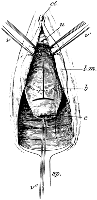 Anterior Colpotomy