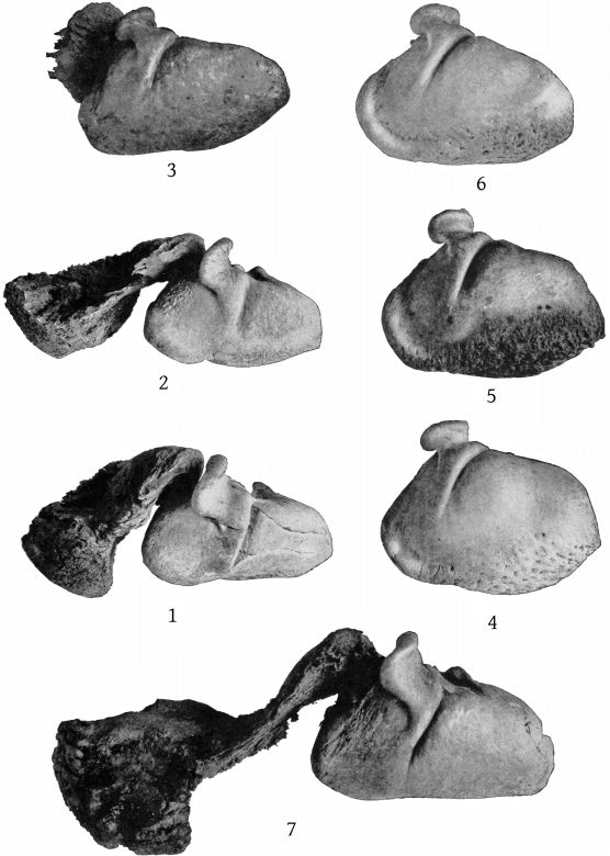 Plate 35 TYMPANIC BONES OF MESOPLODON, ZIPHIUS, AND BERARDIUS