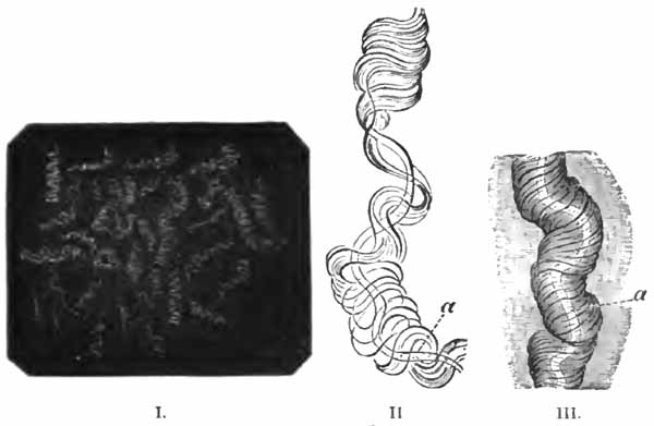 Curschmann's spirals