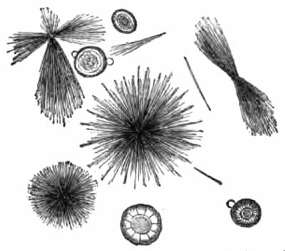 Leucin spheres and tyrosin needles