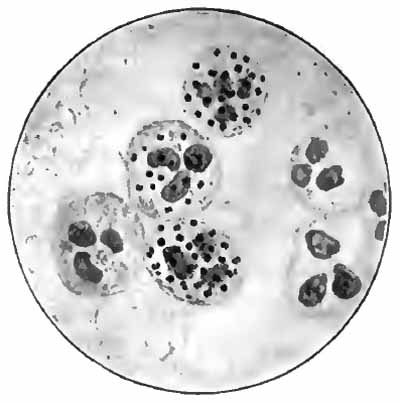 Gonococci