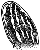 X-RAY OF FOOT  Properly housed in form fitting shoes