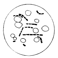 Bacillus of Anthrax and Blood Corpuscles