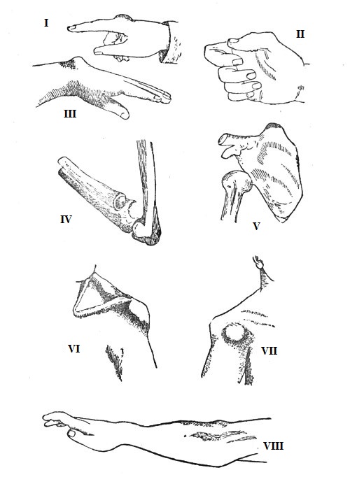 DISLOCATIONS.