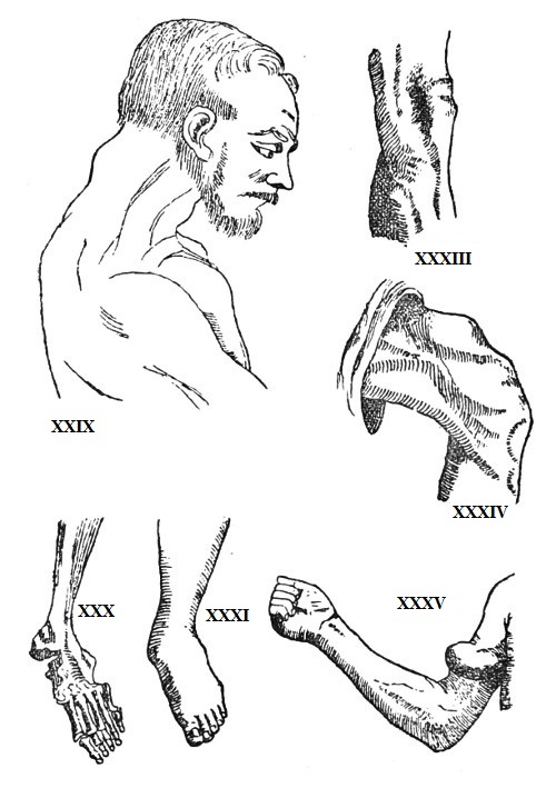 DISLOCATIONS AND RUPTURES.