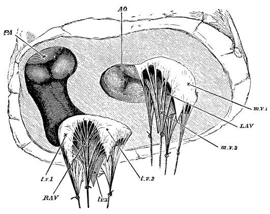 Image unavailable: Fig. 10.—View of the Orifices of the Heart from below, the whole of the Ventricles having been cut away.  R.A.V. right auriculo-ventricular orifice surrounded by the three flaps, t.v. 1, t.v. 2, t.v. 3, of the tricuspid valve; these are stretched by weights attached to the chordæ tendineæ.  L.A.V. left auriculo-ventricular orifice surrounded in same way by the two flaps, m.v. 1, m.v. 2, of mitral valve; P.A. the orifice of pulmonary artery, the semilunar valves having met and closed together; Ao. the orifice of the aorta with its semilunar valves. The shaded portion, leading from R.A.V. to P.A., represents the funnel seen in Fig. 8.