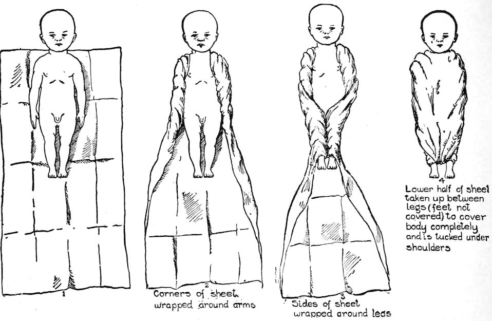 Corners of sheet wrapped around arms Sides of sheet wrapped around legs Lower half of sheet taken up between legs (feet not covered) to cover body completely and is tucked under shoulders