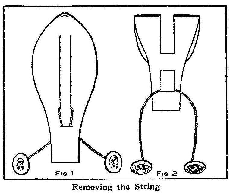 Removing the String