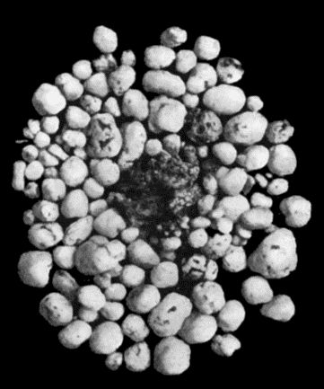 Fig. 168.—Multiple partially ossified Chondromas of Synovial Membrane, from Shoulder-joint, the seat of arthritis deformans, from a man æt. 35.